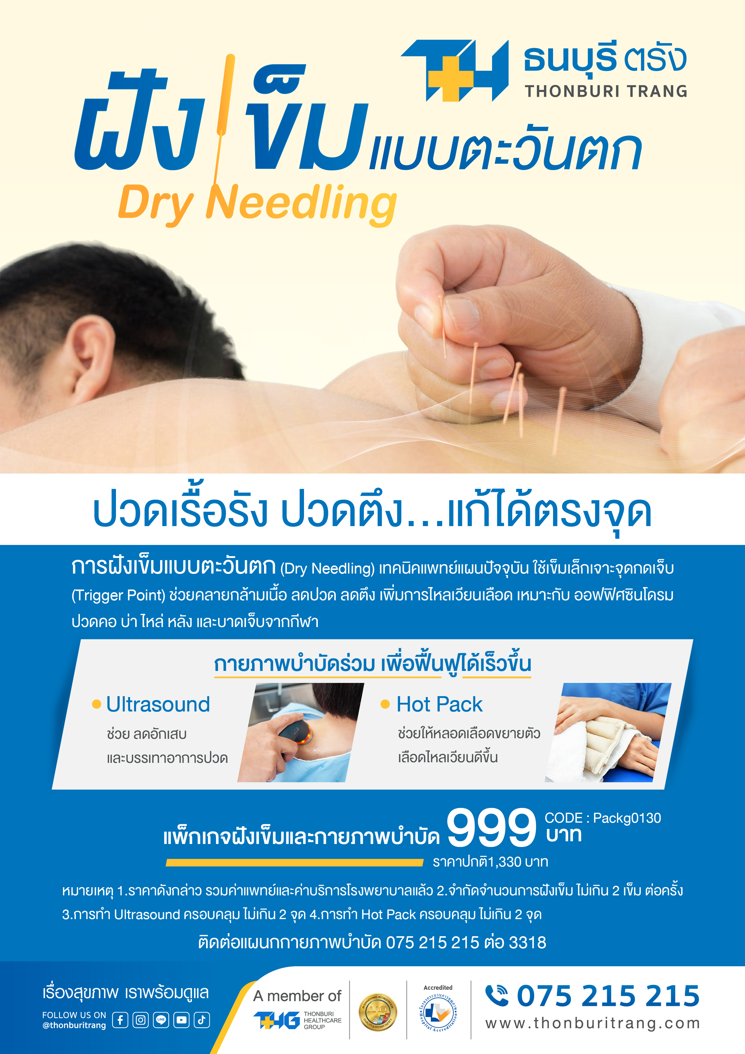 แพ็กเกจฝังเข็มแบบตะวันตก